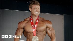 Frequently Asked Questions About the Use of Anabolic Steroids in Bodybuilding